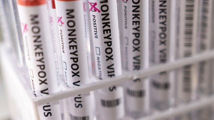 Belgium makes 21-day quarantine compulsory for monkeypox patients