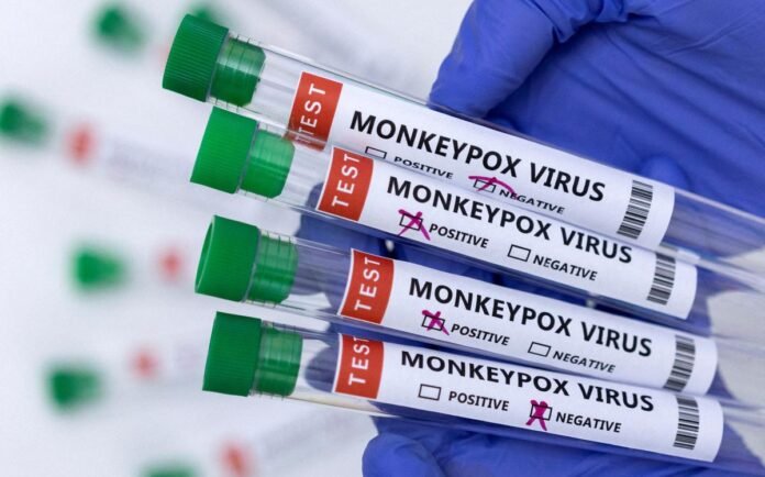 Brussels confirms four more cases of monkeypox, takes total to 14 cases in Belgium