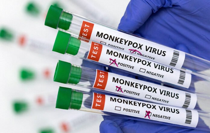 Netherlands logs 818 cases of monkeypox virus: Reports